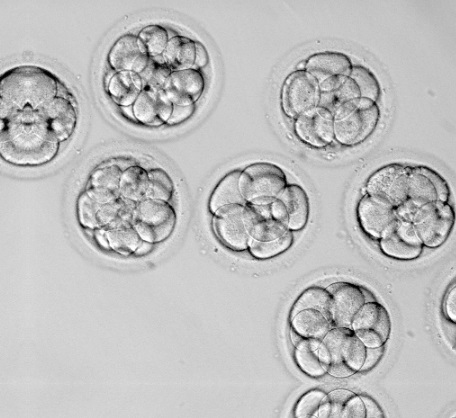 Embryos - Alabama Supreme Court Decision has dire consequences for IVF patients.